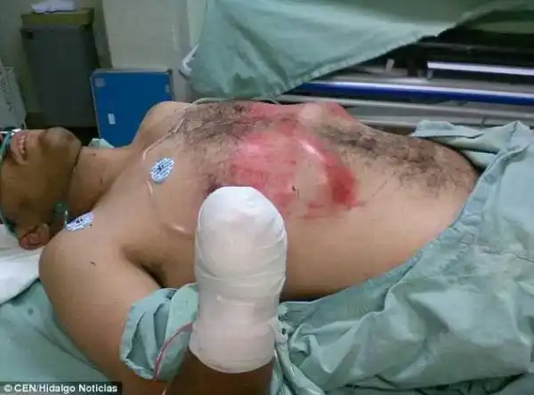 Vigilantes Catch Two Thieves Breaking Into Peoples Homes...What They Did to Them Will Shock You (Photos)